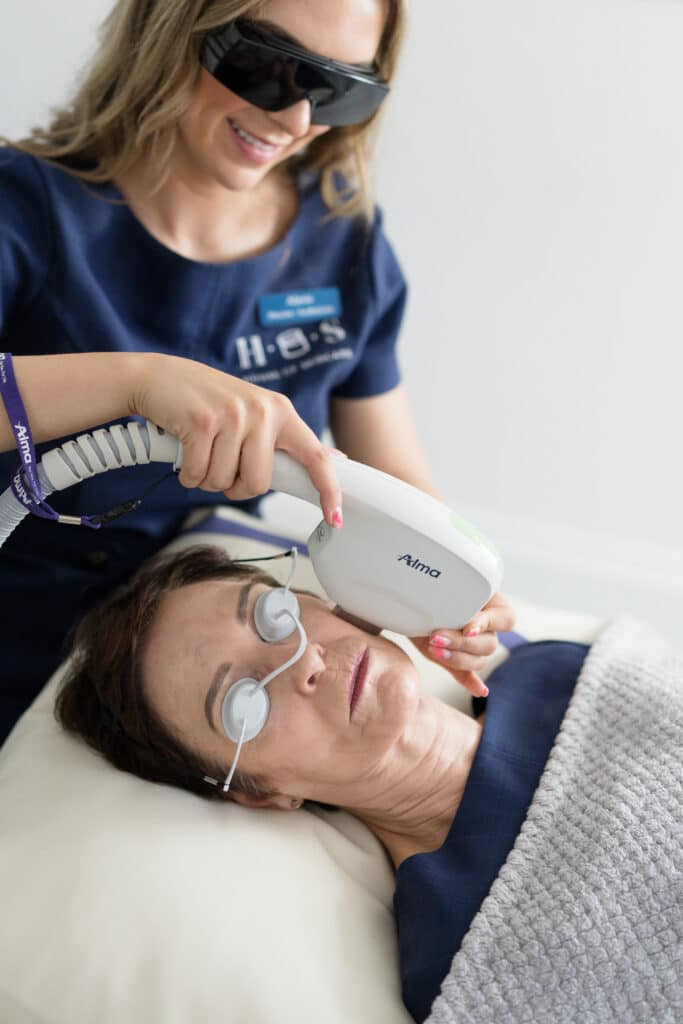 DYE VL - red vein laser removal on face