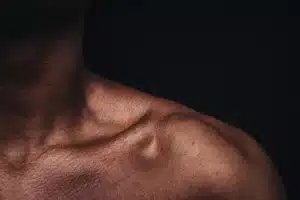 Laser Hair Removal for Men Exeter
