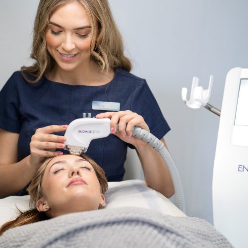 Endymed FSR Acne treatment Exeter