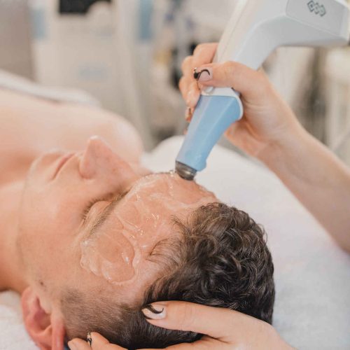 Male exilis radiofrequency skin tightening Exeter